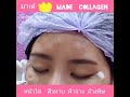 ฉีดมาเด้คอลลาเจน