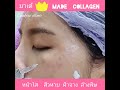 ฉีดมาเด้คอลลาเจน