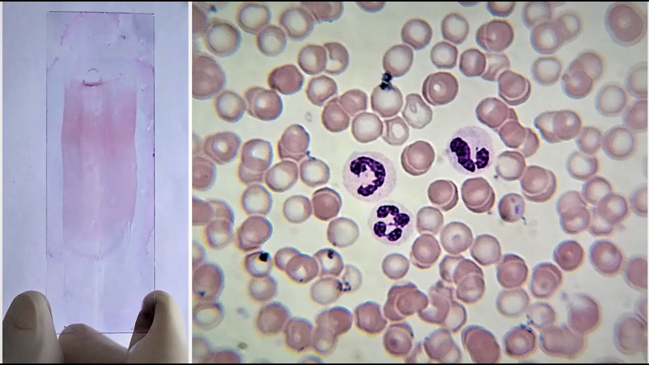 Blood Smear Preparation and Staining Practical Lab