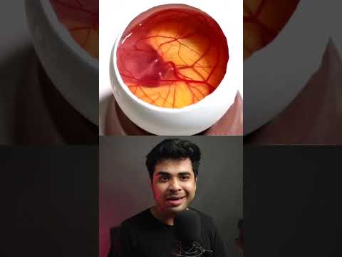 How A Chick Born From An Egg 😱🐣