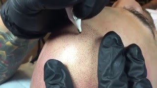 Scalp Micropigmentation -Bryce Cleveland educating about the process