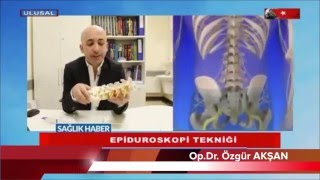 Epiduroskopi TV - 2
