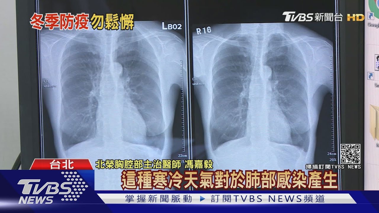 天冷!新冠病毒存活率高!全球疫情嚴峻 專家警告這件事