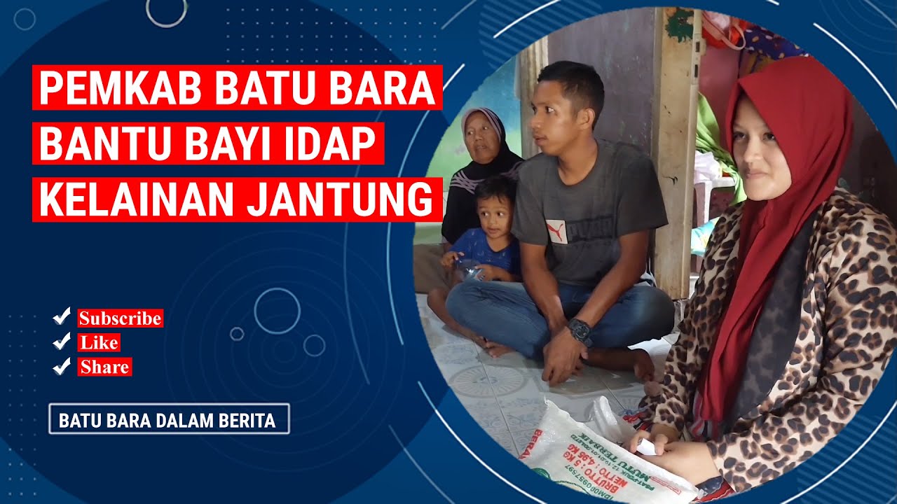 PEMKAB BATUBARA BANTU BAYI IDAP KELAINAN JANTUNG