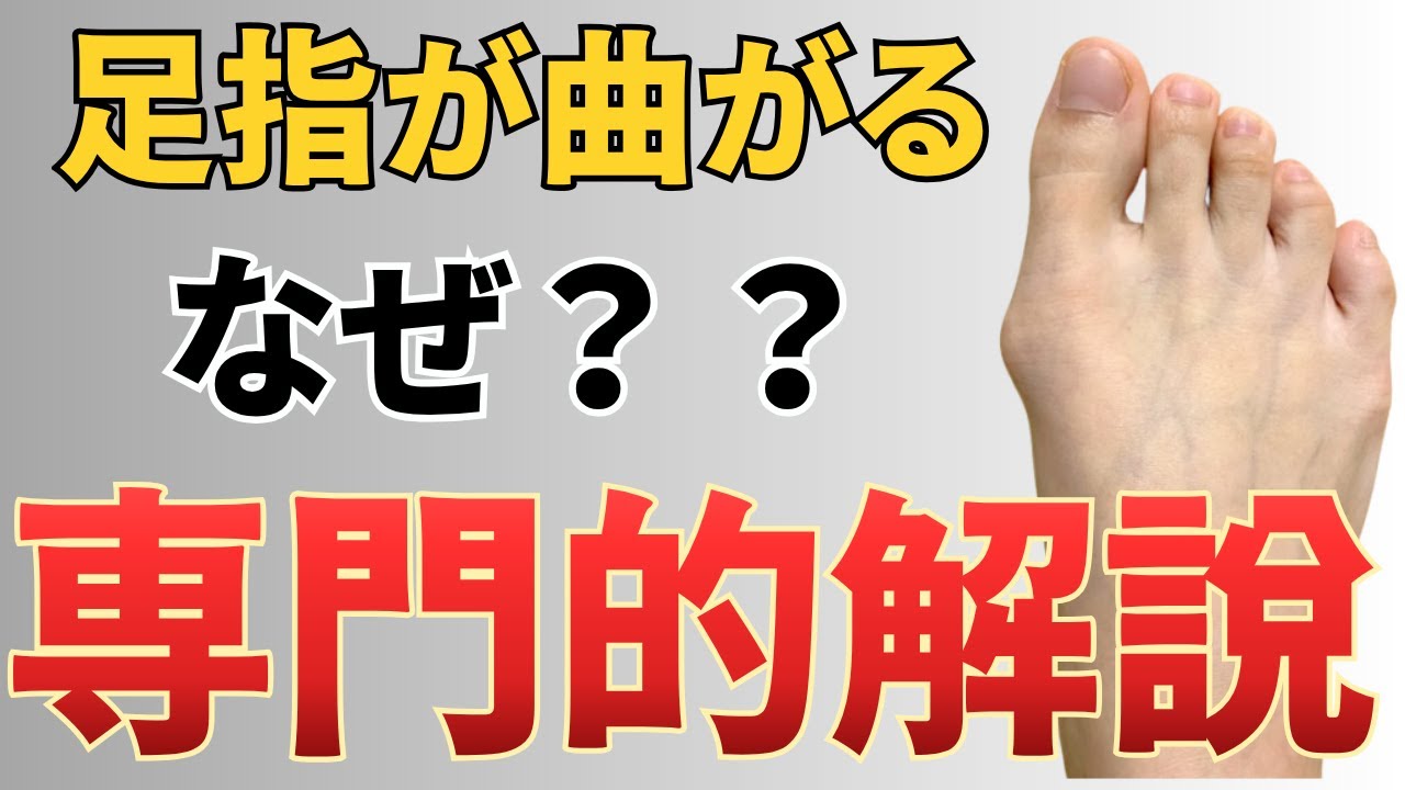 脳梗塞リハビリ‼︎足指が曲がるのはなぜ？？を専門的に解説