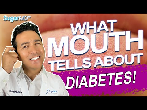 Diabetic’s Mouth! What’s Inside?