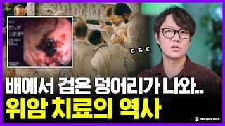 죽은 사람의 배를 갈랐을 때 나온 검은 덩어리의 정체는..!? | 의학의 역사 위암편