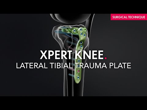 Surgical technique - Lateral tibial trauma plate - Xpert Knee