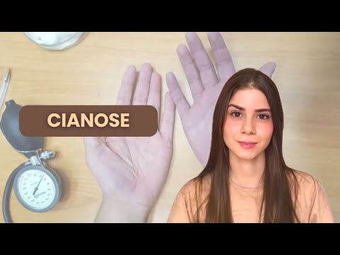 INTERVENÇÕES CLÍNICAS: CIANOSE ep. 1 | definição, fisiopatologia, tipos, riscos, condutas 🩺 