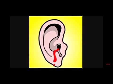 The loudest music In the world