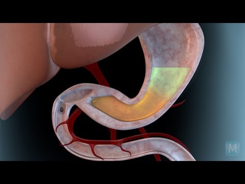 How Your Digestive System Works? | Match Health