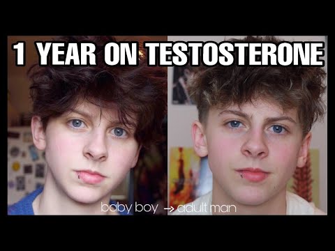 1 YEAR ON TESTOSTERONE (TRANSGENDER FTM) | NOAHFINNCE