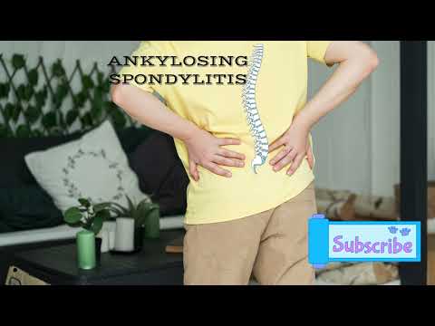 Ankylosing spondylitis pronunciation/How to pronounce Ankylosing spondylitis ( medical term)