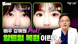 배우 강예원 PICK✔ 앞트임 복원이란❔｜눈성형｜윤현준 원장