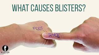 What Causes Blisters On Feet?