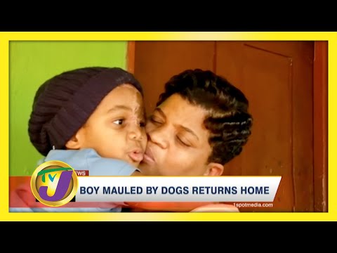 Boy Mauled by Dogs Returned Home January 7 2021