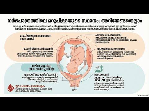 Placental Location — video thumbnail