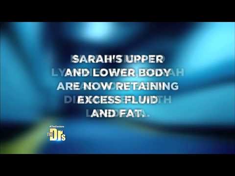 Living with Lymphedema and Lipedema Part 2