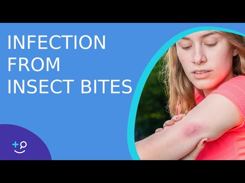 Skin Infection From Bug Bites - Daily Do's of Dermatology