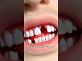 Can You Really Regrow Teeth Japan S New Drug Explained Short Creativelearning3d