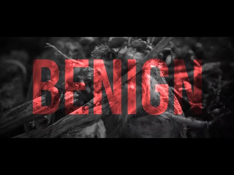 SCAPHIST - BENIGN (FT. DEVIN SHIDAKER OF THE ACACIA STRAIN) [OFFICIAL LYRIC VIDEO] (2025) SW EXCL