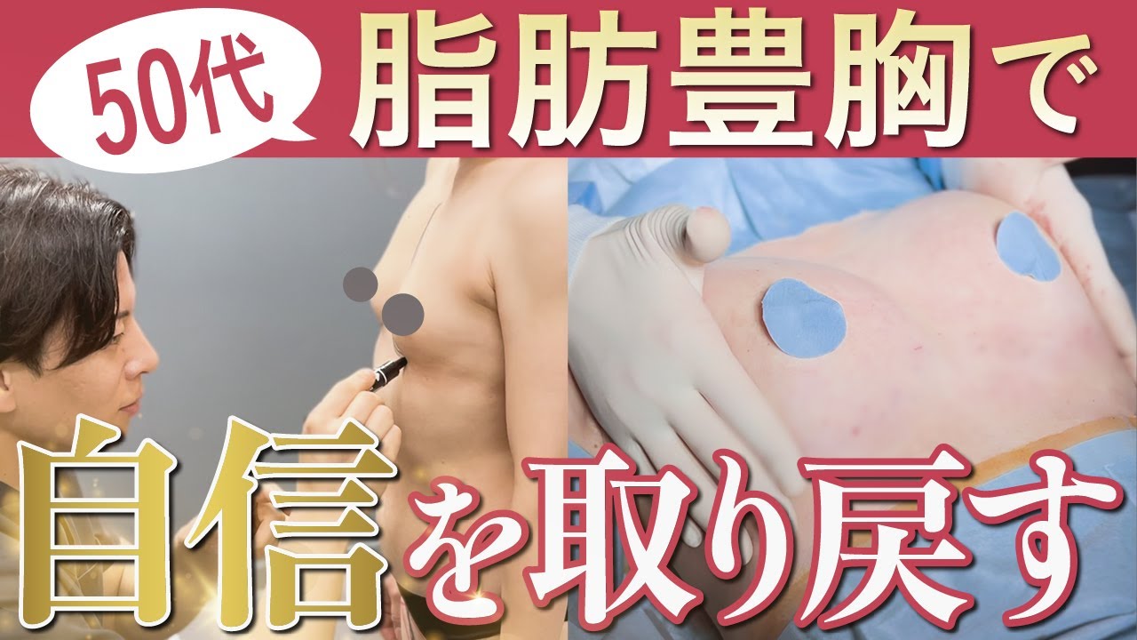 50代からの脂肪豊胸!自分の脂肪で理想のバストを実現