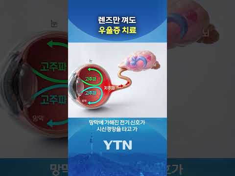 우울증 치료 '렌즈' #shorts / YTN