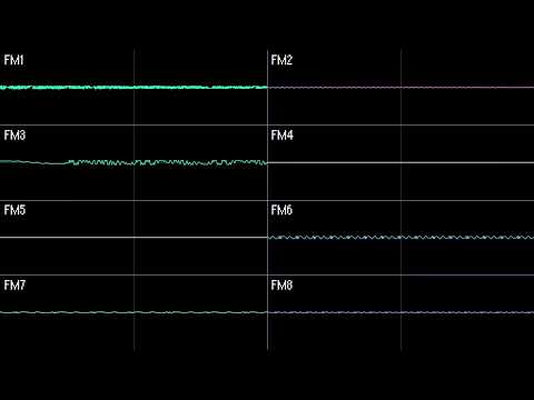 Stage 2 (YM2151 Arrangement) - Kirby's Block Ball