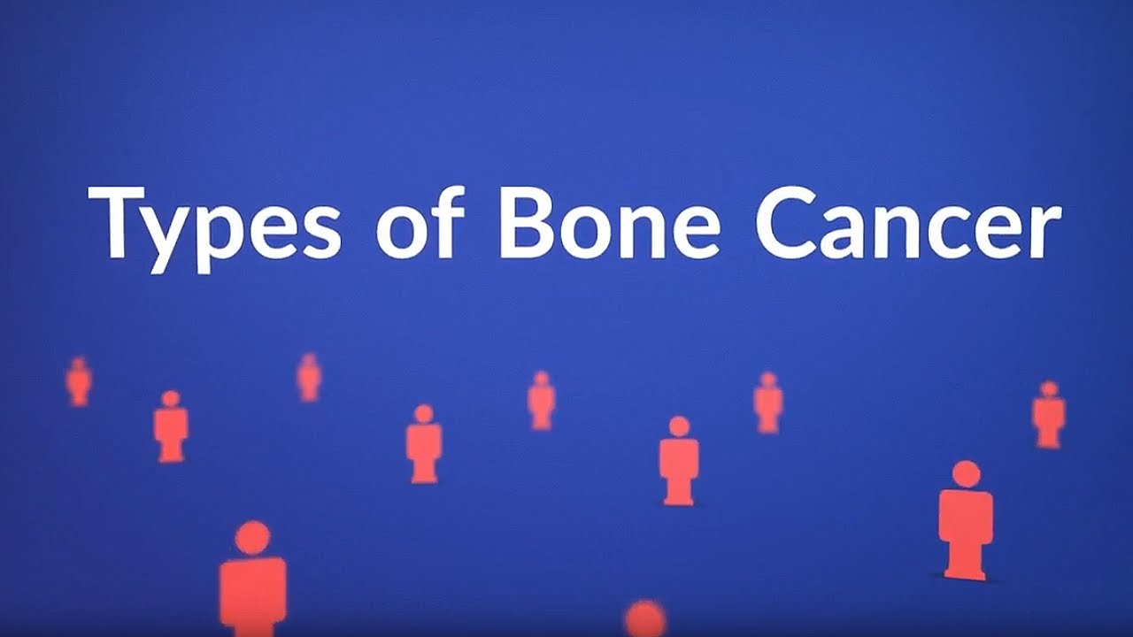Types of Bone Cancer (List, Symptoms, Treatments) - YouTube