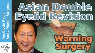 Dr. Philip Young
