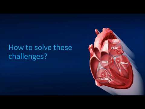 GE Vivid Club   Clinical Library   New aspects in 4D Ultrasound imaging on Transesophageal Echo for