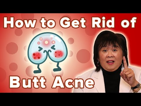 How To Get Rid Of Butt Acne