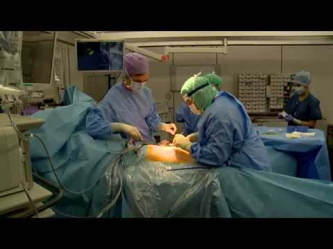 1-2 Osteoarthritis Schritt Schultergelenk Bandage ist beschädigt Schultergelenk