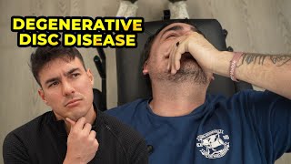 Veteran With Degenerative Disc Disease Gets Relief | CleanSpine (Dr. Tyler Bigenho, DC)