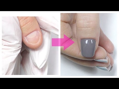 Short Bitten Nails Transformation