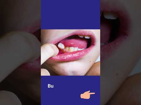 Can kids wiggle their loose tooth?