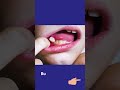 Can kids wiggle their loose tooth?