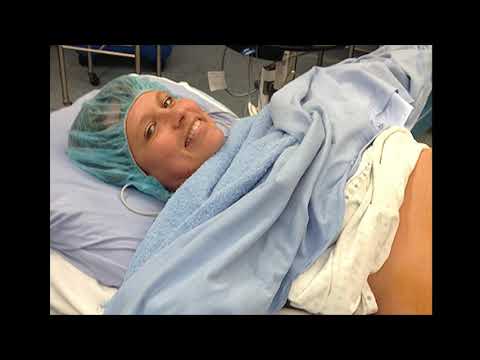 Learn more about elective cesarean section