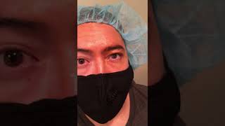 Pterygium Removal Surgery Before and After | Dr. Franz Michel | 2 of 3