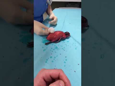 She sprinkle glitters all over her and Now its not getting off.