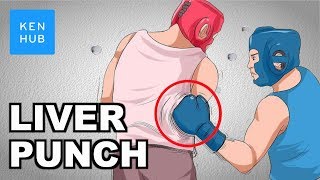 Why can&#39;t your body handle a punch to the liver? - Human Anatomy | Kenhub