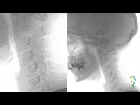 Malattie del gomito in immagini Psicosomatica articolazioni dolenti delle dita