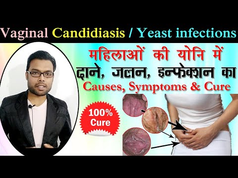 महिलाओं की योनि में दाने, जलन और इन्फेक्शन का इलाज | candida yeast infection treatment | Ayurvedic Video