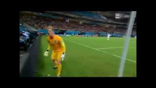 Joe Hart losing his Head and Shoulders