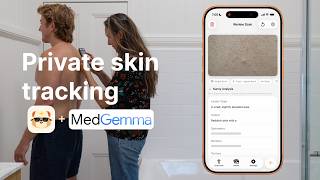 Introducing Sunny - A MedGemma-Powered Skin Health Tracking App (Kaggle Competition Entry)
