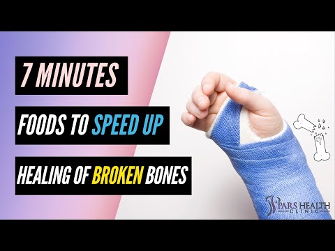 Eat These Foods to Speed up Healing of Broken Bones