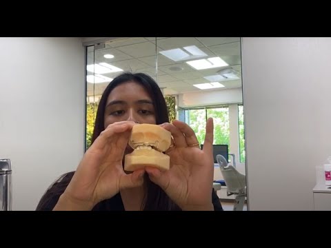 How to Care For and Maintain Your Orthodontic Bionator