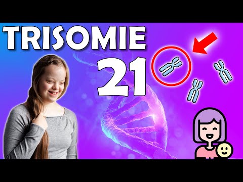 Down Syndrom - Trisomie 21 | Symptome, Auswirkungen & Förderung