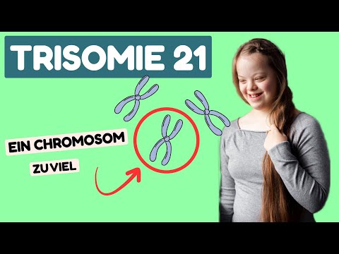 Down Syndrome - Trisomy 21 | Symptoms, Effects & Support
