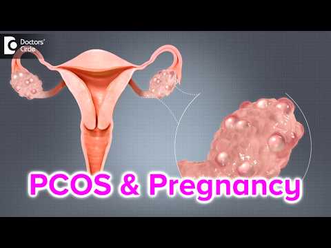 What happens if I have PCOS and I get pregnant? - Dr. Bala R